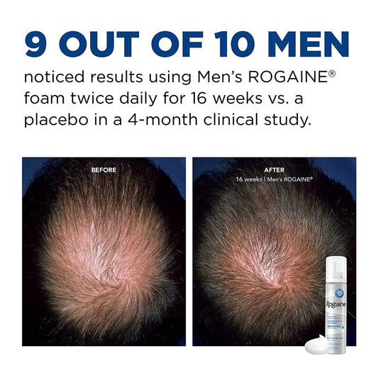 解救男士脫髮 Rogaine 5% Minoxidil Foam 男士防脫髮增髮泡沫