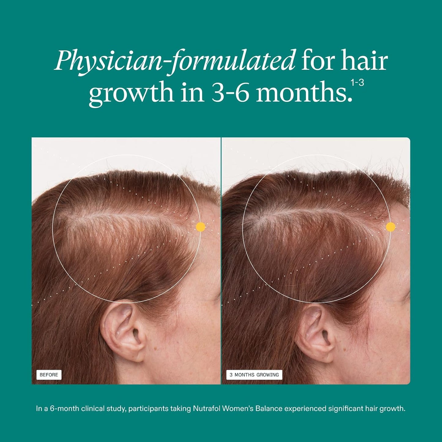Nutrafol Women Hair Growth Supplements 女士頭髮生長營養補充劑 1個月裝