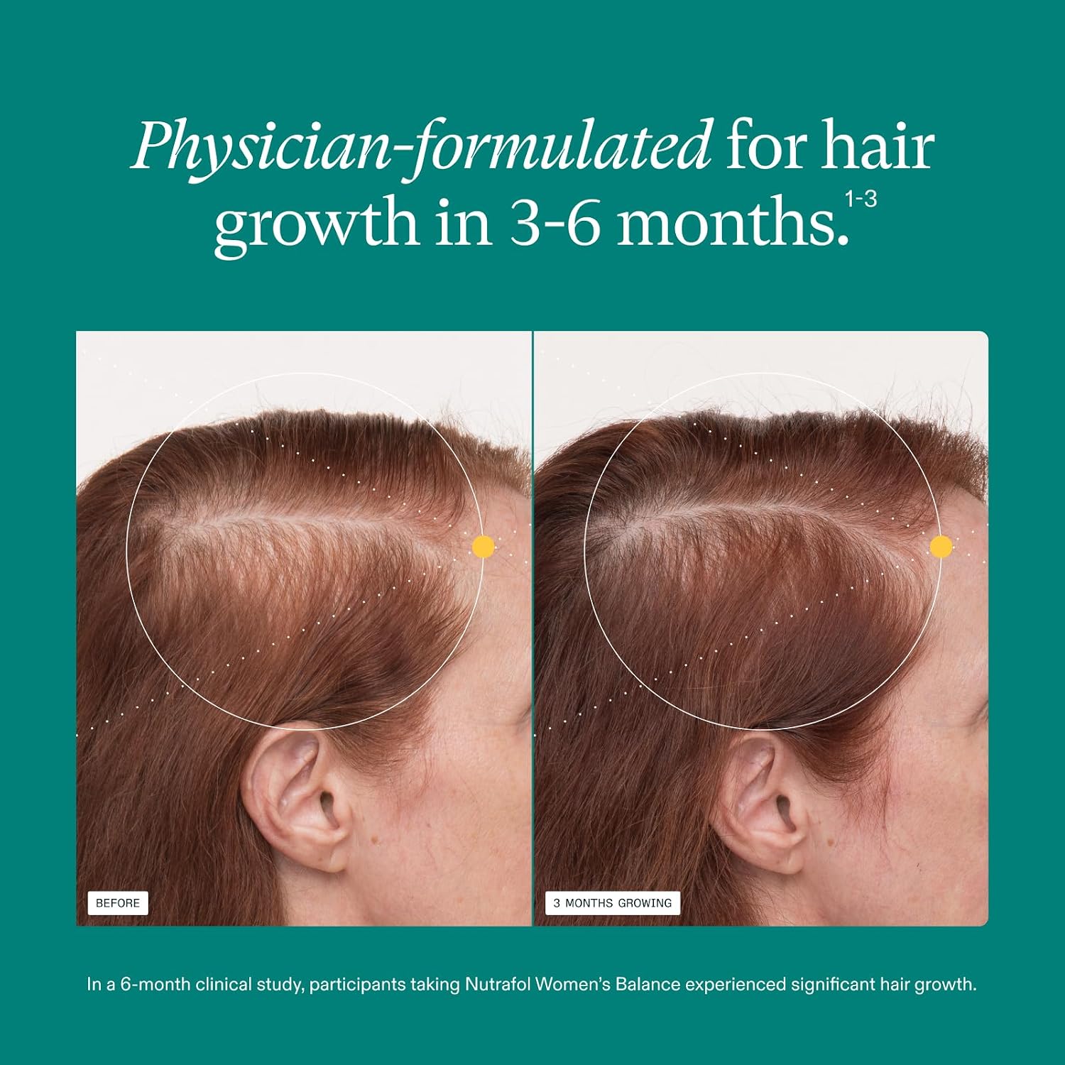 Nutrafol Women Hair Growth Supplements 女士頭髮生長營養補充劑 1個月裝